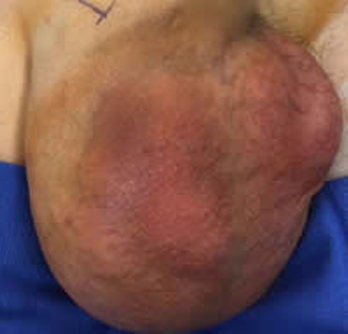 Case Study 4 Before Surgery First Set