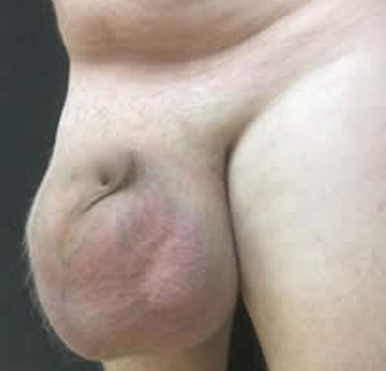 Case Study 4 Before Surgery Second Set