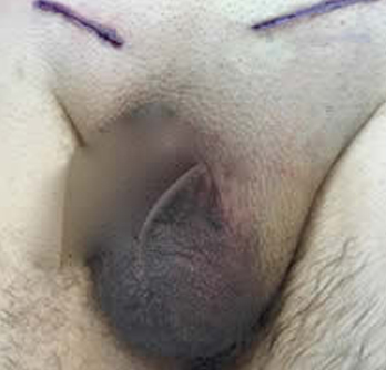 Case Study 6 After Surgery