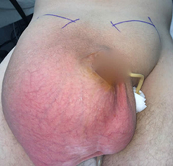 Case Study 1 Before Surgery