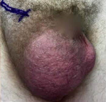 Case Study 5 Before Surgery
